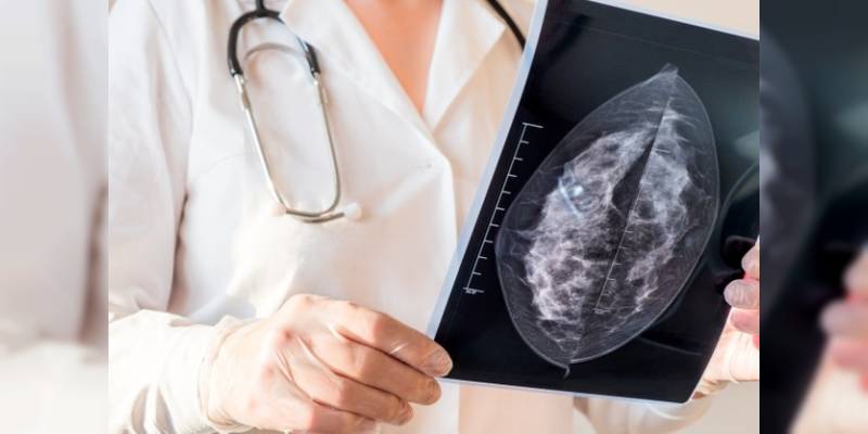mamografi-gerekli-mi-yoksa-riskli-mi